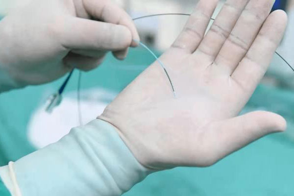 PTCA冠脈球囊導(dǎo)管激光打孔工藝 PTCA冠脈球囊導(dǎo)管激光打孔工藝